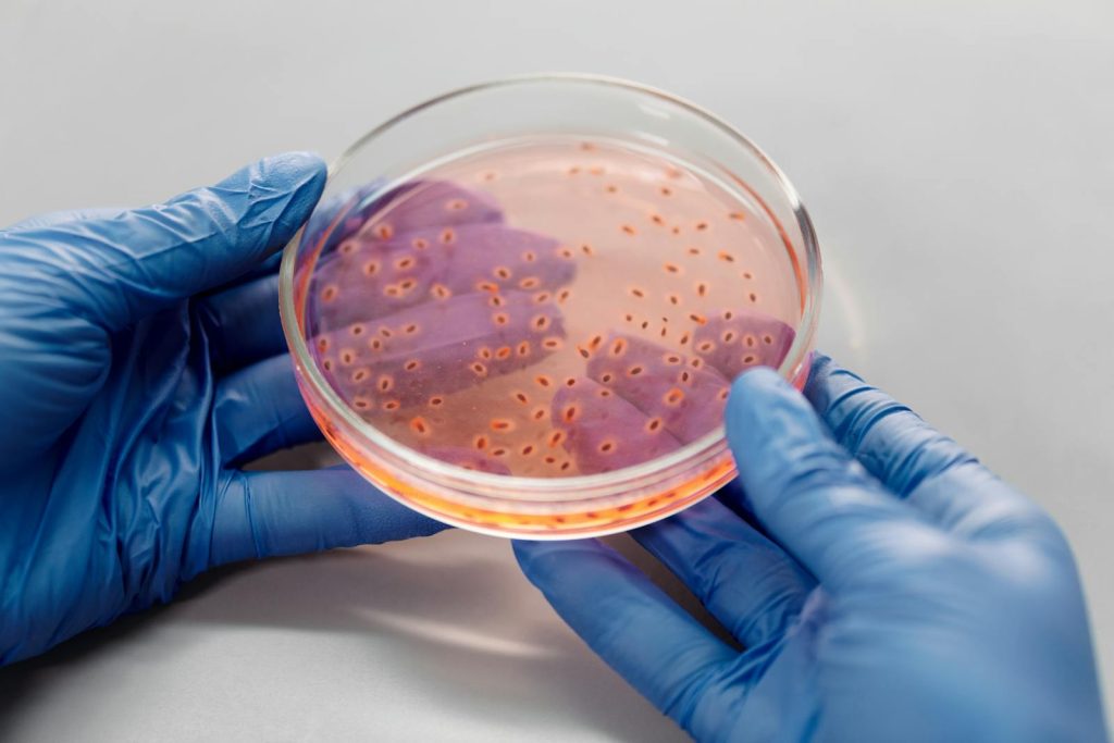 Close-up of gloved hands holding a petri dish with bacterial culture in a lab setting.