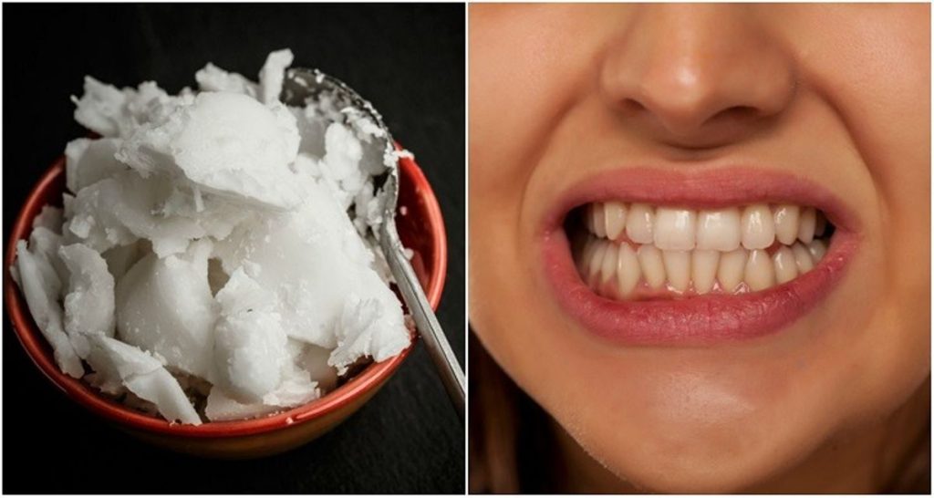 coconut oil pulling
